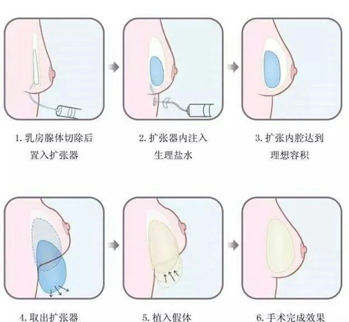 微信圖片_20240705082658.jpg